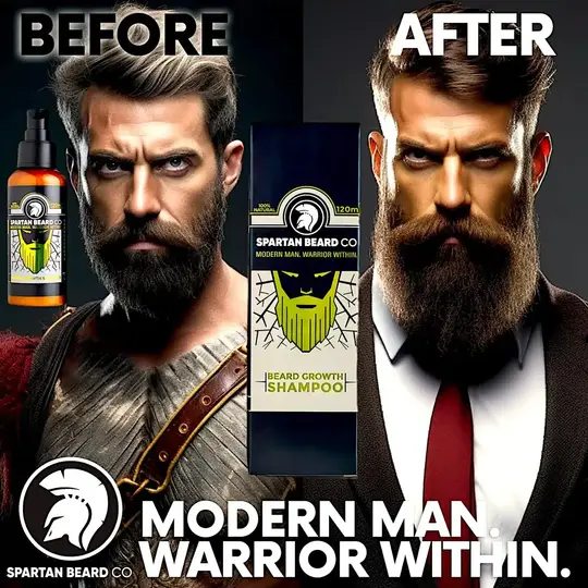 𝗦𝗣𝗔𝗥𝗧𝗔𝗡 𝗕𝗘𝗔𝗥𝗗™ แชมพู (ลด 80% - สั่งซื้อครั้งแรก)